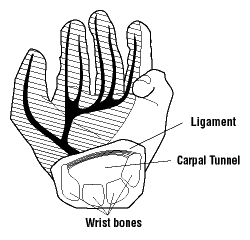 Carpal tunnel